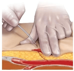 OneStop Vascular Technology